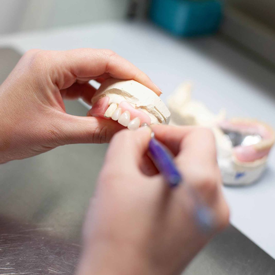 Refinding the teeth on newly created dentures