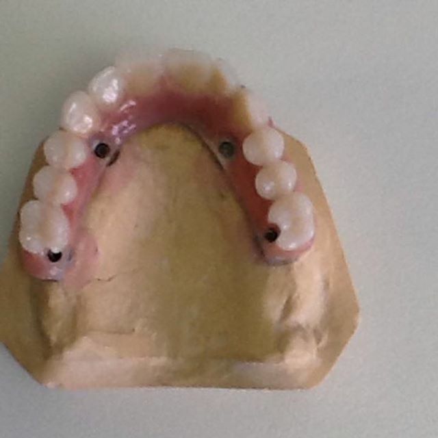 Dentures in a mould 