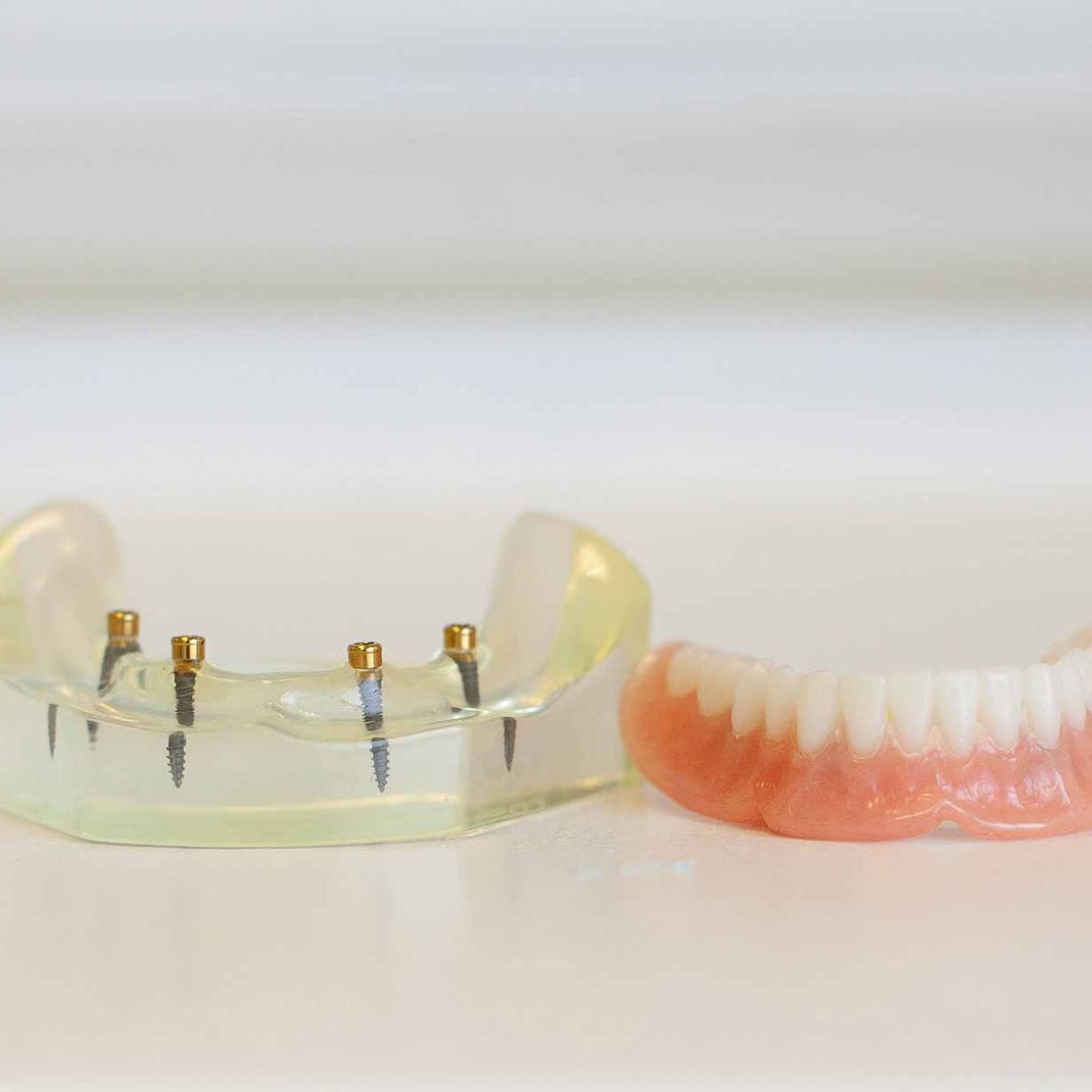 Finsihed dentures next to a transparent mould