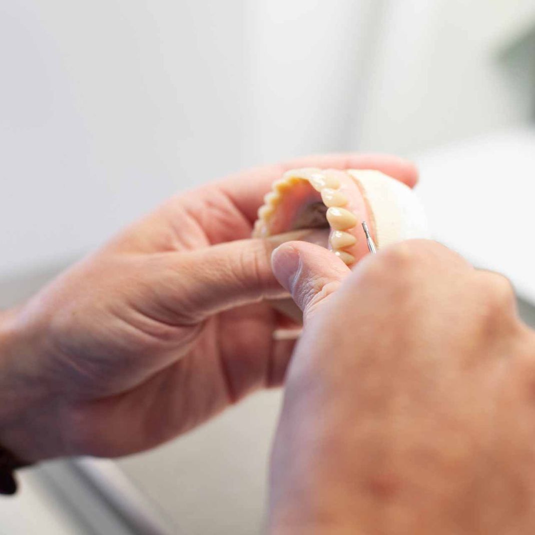 Dentist inspeciting newly moulded dentures 