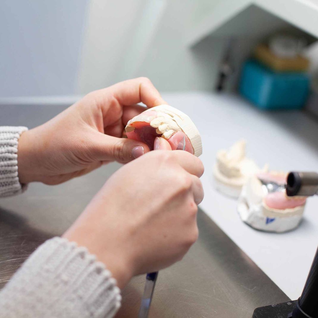 Taking new denturs out a mould 