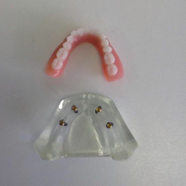 Completed dentures beside a transparent mould 