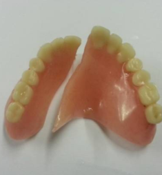 Denture Repairs