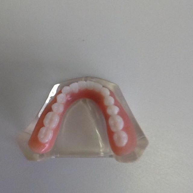 Newly finished dentures still inside a transparent mould