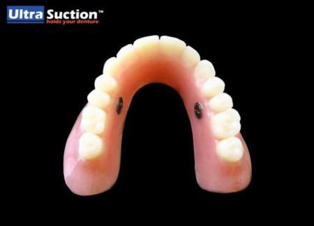 Ultra Suction™ Dentures