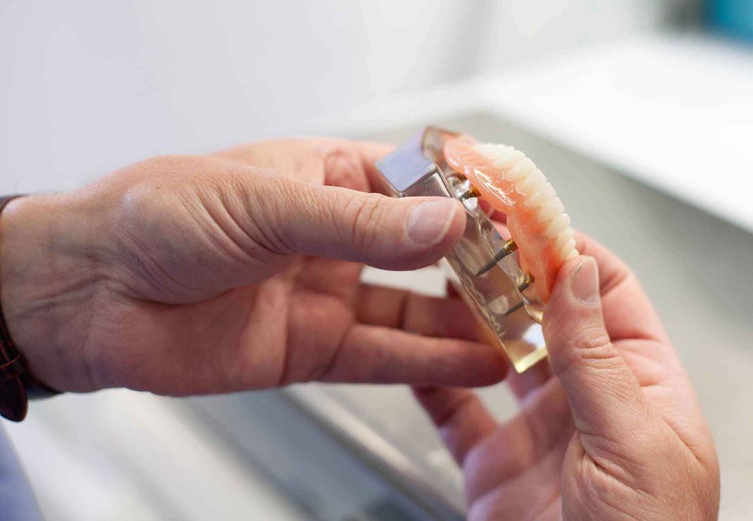 Dentist checking out dentures