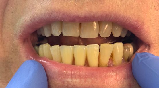 Walkinstown Dental Studio