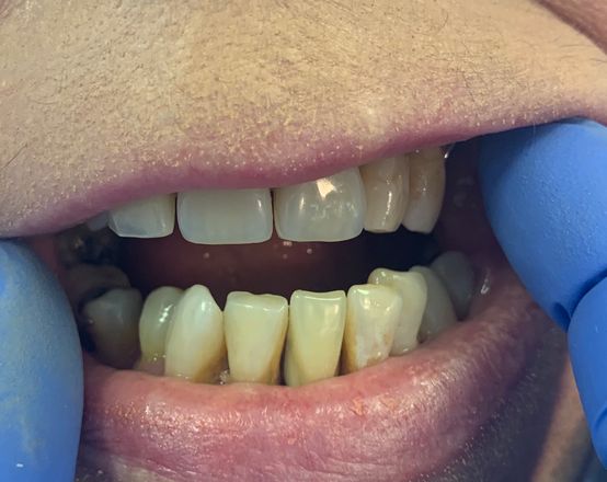 Walkinstown Dental Studio