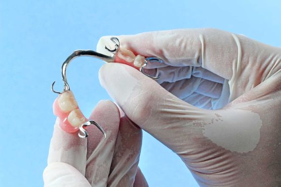 Partial Dentures being fitted